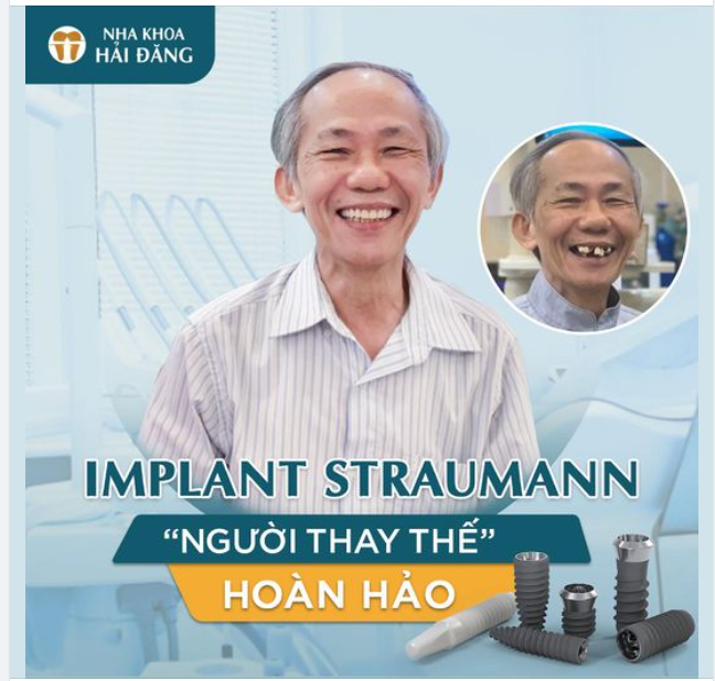 IMPLANT STRAUMANN THAY THẾ HOÀN HẢO CHO RĂNG MẤT