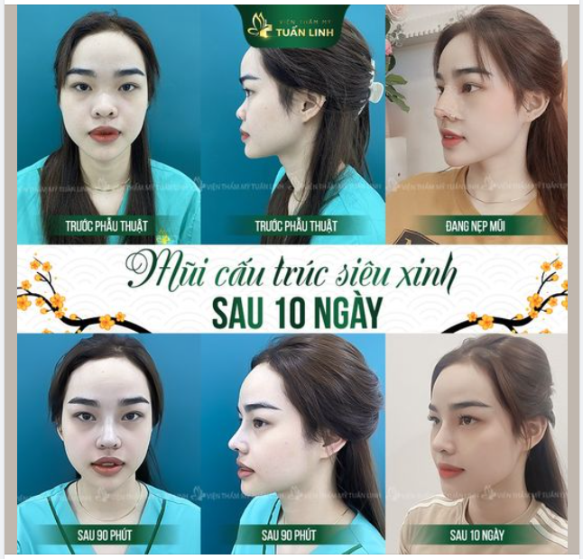 RĂNG SỨ THẨM MỸ - XU HƯỚNG LÀM ĐẸP ĐƯỢC NHIỀU NAM GIỚI LỰA CHỌN