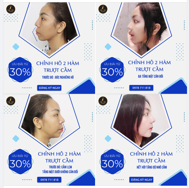 Chị khách tự tin hơn…Sau cuộc "giải cứu" thành công do Tiến Sĩ Bác Sĩ Đỗ Thành Trí thực hiện