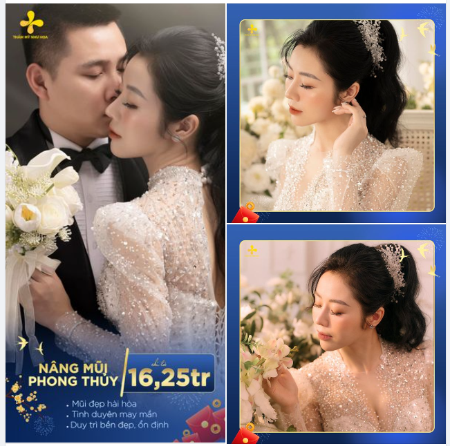 CHỈ TỪ 16,25 TRIỆU, BẠN SẼ SỞ HỮU DÁNG MŨI PHONG THỦY - TÌNH DUYÊN MAY MẮN