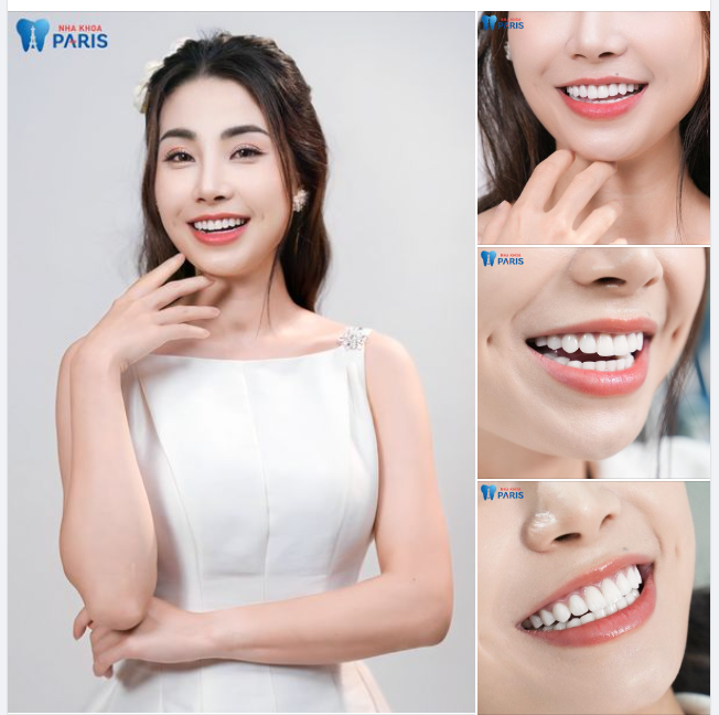 Du học sinh muốn bọc răng sứ "cấp tốc" và cái kết