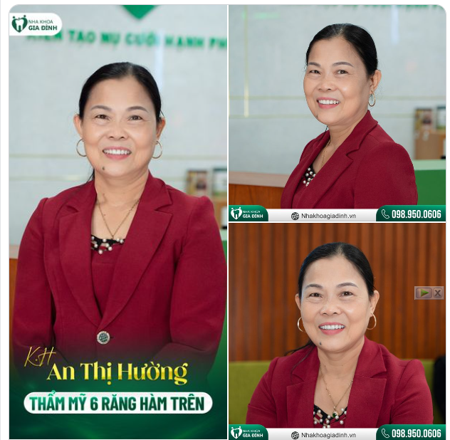 SỞ HỮU HÀM RĂNG SÁNG ĐẸP KHÔNG PHÂN BIỆT TUỔI TÁC