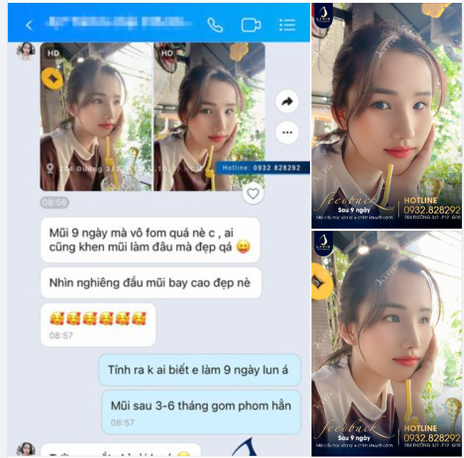 Đón Tết Giáp Thìn với dáng mũi cao xinh