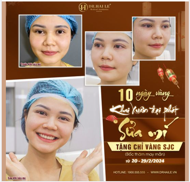 10 ngày vàng mở cửa Khai xuân, Dr.Hải Lê lì xì chị em ngàn ưu đãi sửa mí hấp dẫn!