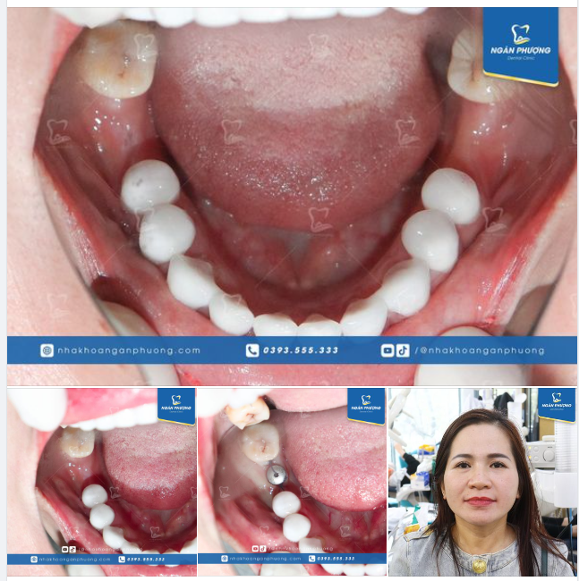 Làm gần hết dịch vụ Nha khoa là cảm giác như thế nào?