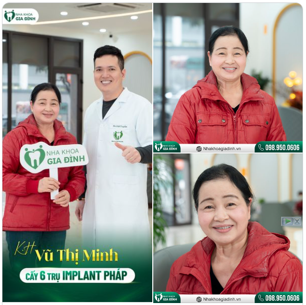 “Răng lợi cô chán lắm. Ăn không được mà ngủ cũng không yên" - Đây là những chia sẻ của cô Vũ Thị Minh về tình trạng mất răng đã làm “xáo trộn" cuộc sống của cô bấy lâu nay.