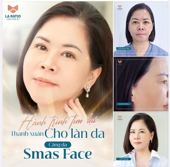 HÀNH TRÌNH TÌM LẠI THANH XUÂN CHO LÀN DA