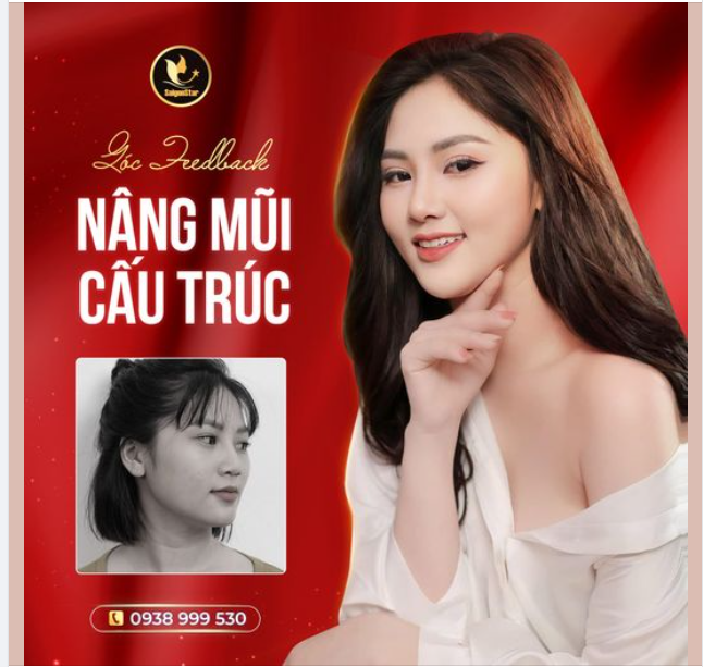 Hình này không có cap. Vì chính “feedback khách” là nội dung