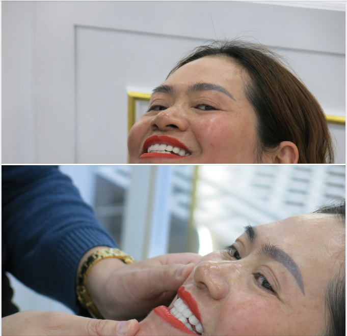 Bọc răng sứ có giống răng thật không?