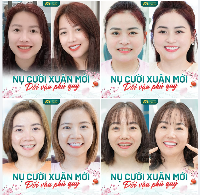 NỤ CƯỜI XUÂN MỚI - ĐỔI VẬN PHÚ QUÝ