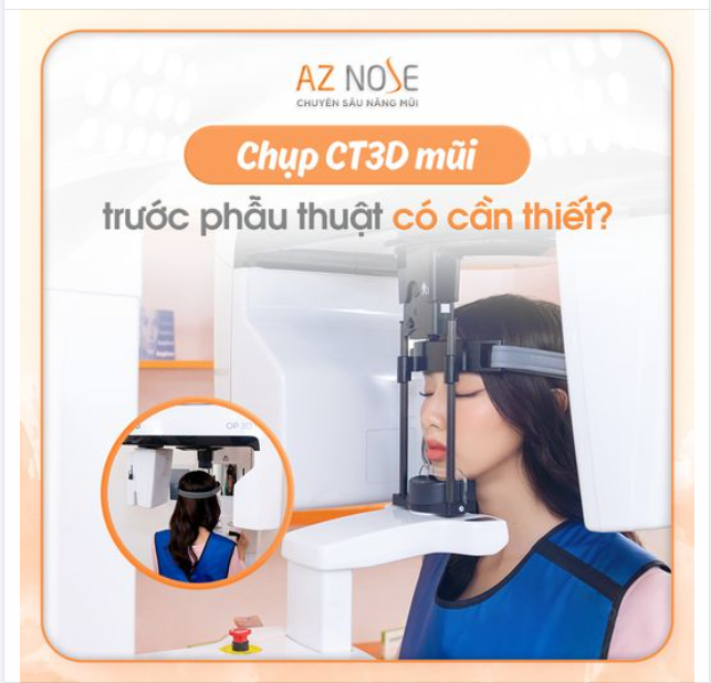 CHỤP CT3D TRƯỚC NÂNG MŨI CÓ CẦN THIẾT?