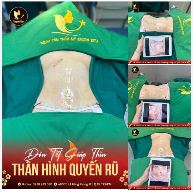 ĐÓN TẾT GIÁP THÌN VỚI THÂN HÌNH QUYẾN RŨ