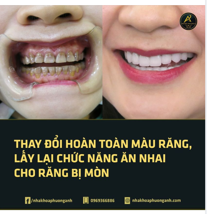 Một sự thay đổi cần thiết sẽ giúp bạn có nhiều suy nghĩ tích cực hơn