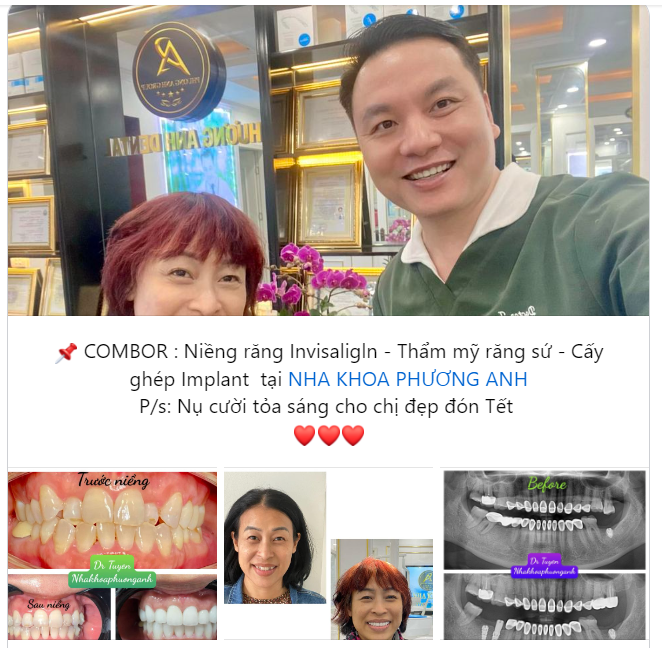 Nụ cười tỏa sáng cho chị đẹp đón Tết