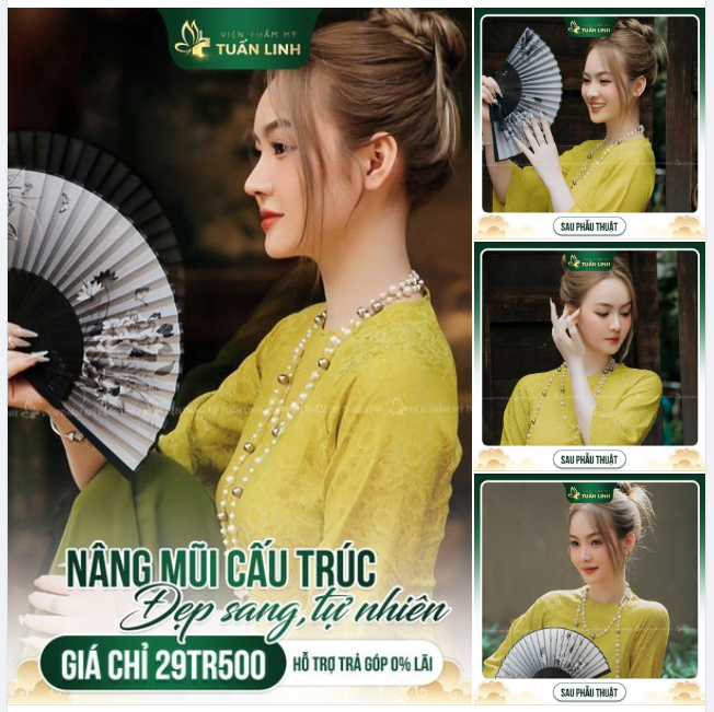 NÂNG MŨI VẪN ĐANG CÒN ƯU ĐÃI!!