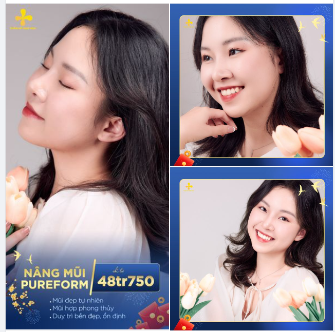 HÔM NAY NÂNG MŨI PUREFORM CHỈ TỪ 48.750.000Đ