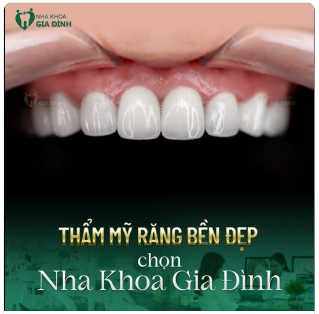THẨM MỸ RĂNG SỨ AN TOÀN, BỀN ĐẸP CHỌN NHA KHOA GIA ĐÌNH