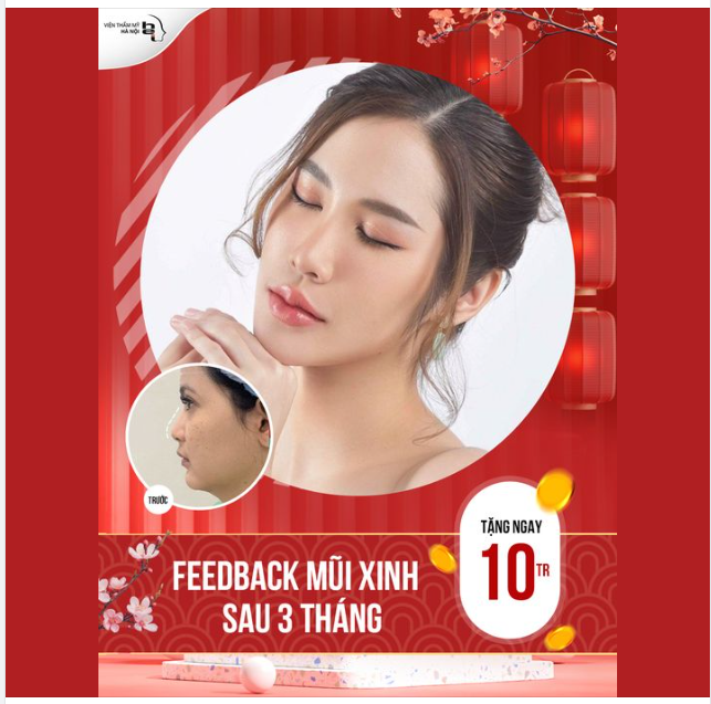 FEEDBACK MŨI XINH SAU 3 THÁNG