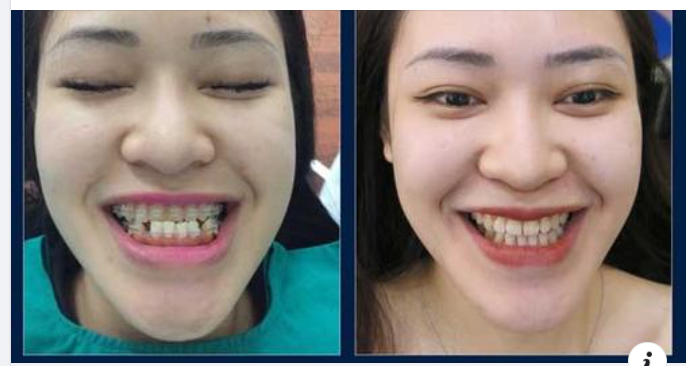 Kế hoạch điều trị chỉnh nha