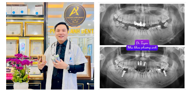 Chỉ cần bạn sống tốt còn mọi thứ “Hữu xạ tự nhiên hương