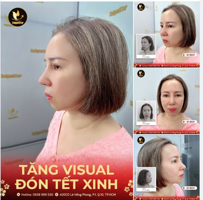 TĂNG VISUAL – ĐÓN TẾT XINH