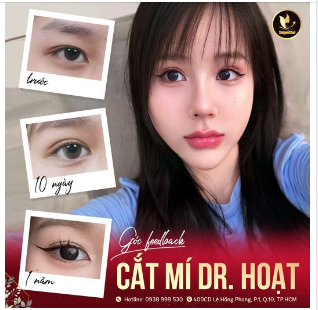 GÓC FEEDBACK CẮT MÍ DR. HOẠT