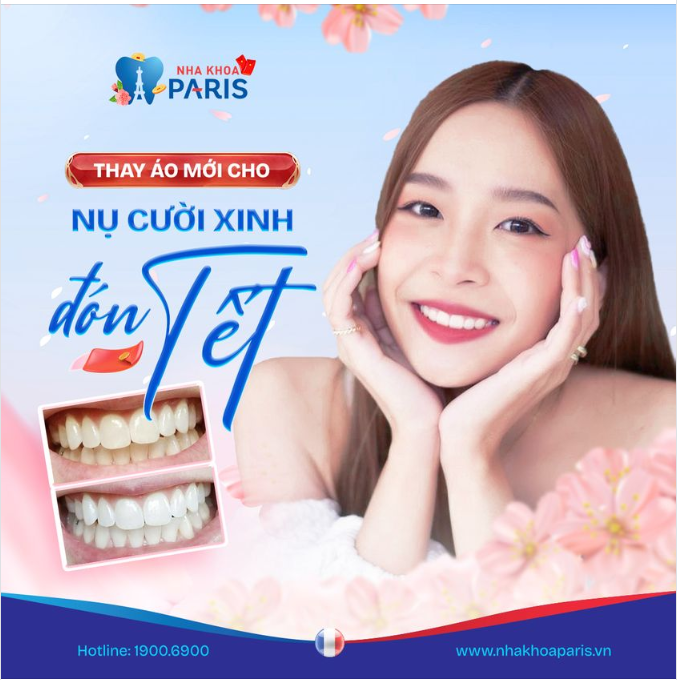 Chỉ sau 45 phút với công nghệ tẩy trắng răng WhiteMax độc quyền tại nha khoa Paris
