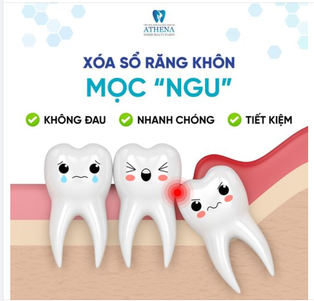 Xóa sổ răng khôn không đau - nhanh chóng - tiết kiệm tại ATHENA
