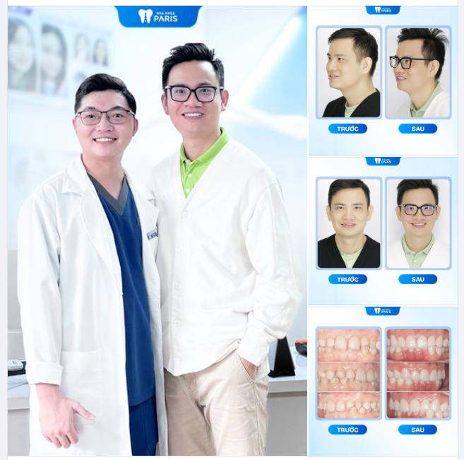 BỌC RĂNG SỨ - THAY SẮC CHO NỤ CƯỜI