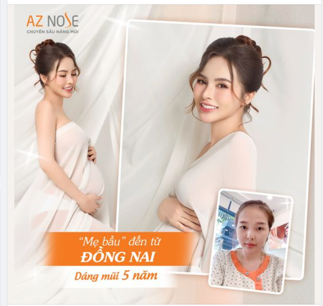 Chụp "ảnh bầu" cực xinh cùng dáng mũi xịn