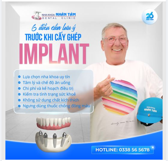 6 điều cần lưu ý trước khi cấy ghép implant