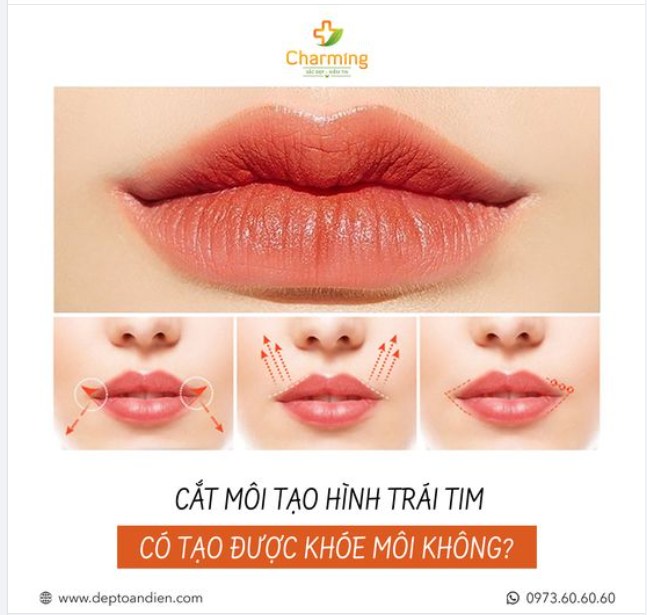 CẮT MÔI TẠO HÌNH TRÁI TIM CÓ TẠO ĐƯỢC KHÓE MÔI KHÔNG?