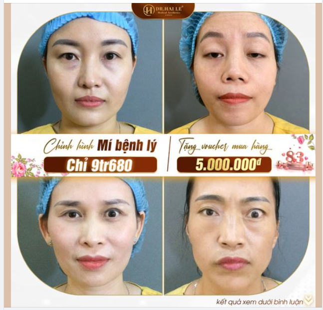 Chị em mí bệnh lý bẩm sinh chú ý! Bỏ qua sẽ rất hối hận đó ạ