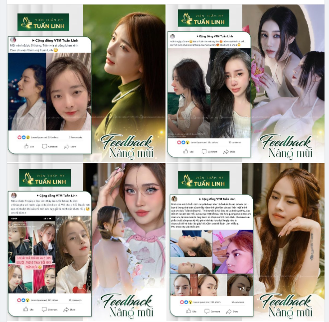 Ai nâng mũi xong cũng xinh xuất sắc thế này