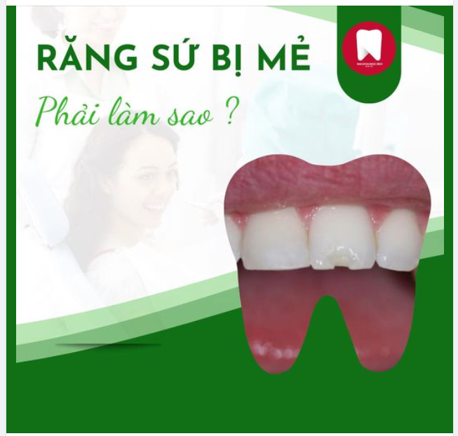 RĂNG SỨ NỨT, MẺ NÊN GIẢI QUYẾT THẾ NÀO?
