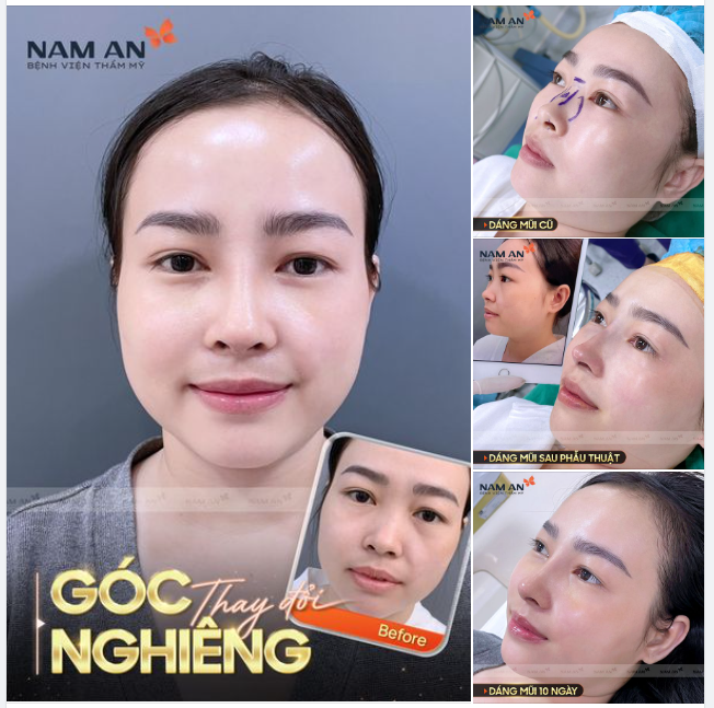 GÓC NGHIÊNG THAY ĐỔI TỪNG GIAI ĐOẠN