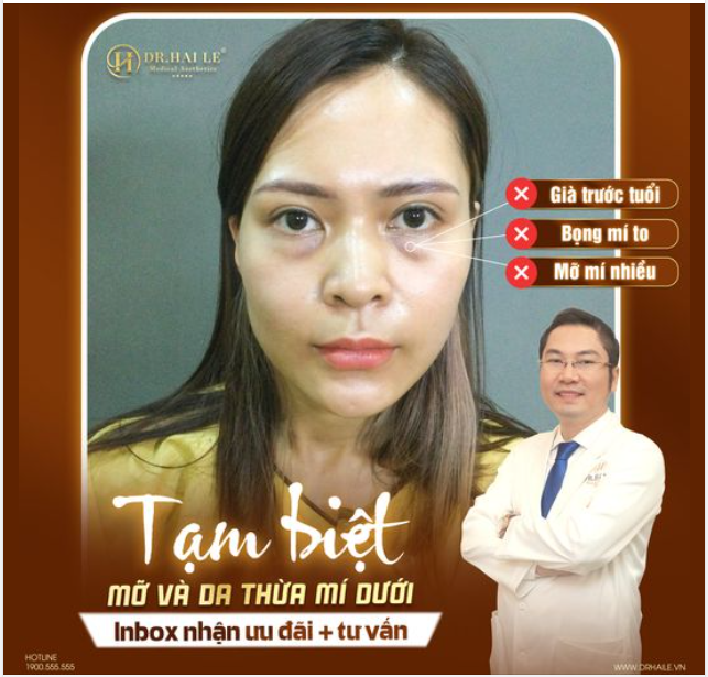 Tạm biệt mí dưới già nua đến Dr Hải Lê cắt mí dưới ngay hôm nay