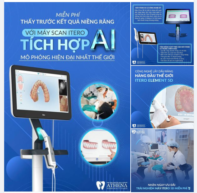 MIỄN PHÍ THẤY TRƯỚC KẾT QUẢ NIỀNG RĂNG VỚI MÁY SCAN ITERO TÍCH HỢP AI DUY NHẤT TẠI ATHENA