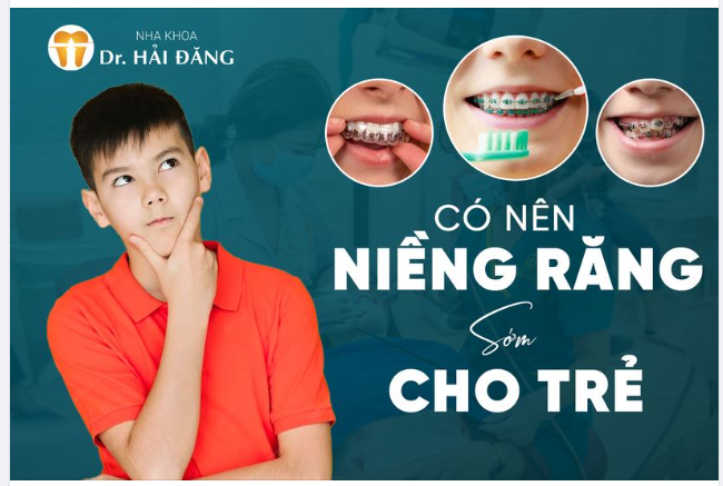 Có nên niềng răng sớm cho trẻ hay không?