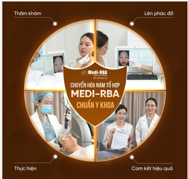 Thực hiện Chuyển hóa nám Medi-RBA  an toàn, chuẩn y khoa