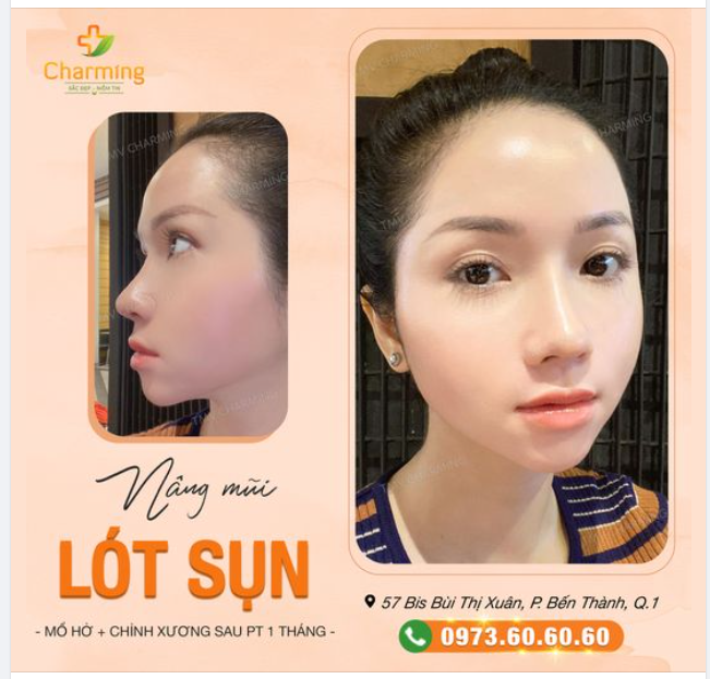 Charming đăng hình feedback của khách lấy tương tác.