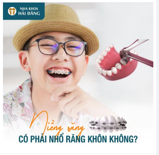 NIỀNG RĂNG CÓ CẦN PHẢI NHỔ RĂNG KHÔN
