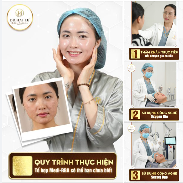  Cấy Mesotherapy không còn xa lạ gì với các chị em vì đây là một phương pháp làm đẹp AN TOÀN và HIỆU QUẢ.