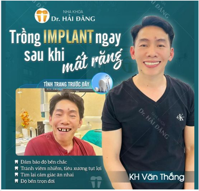 TRỒNG RĂNG IMPLANT CHO RĂNG ĐÃ MẤT - PHỤC HÌNH ĂN NHAI
