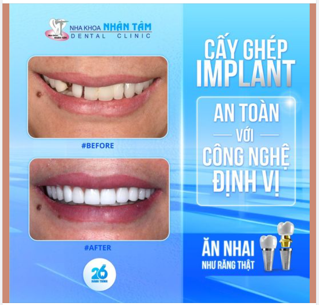 Từ "ám ảnh" nụ cười đến tự tin