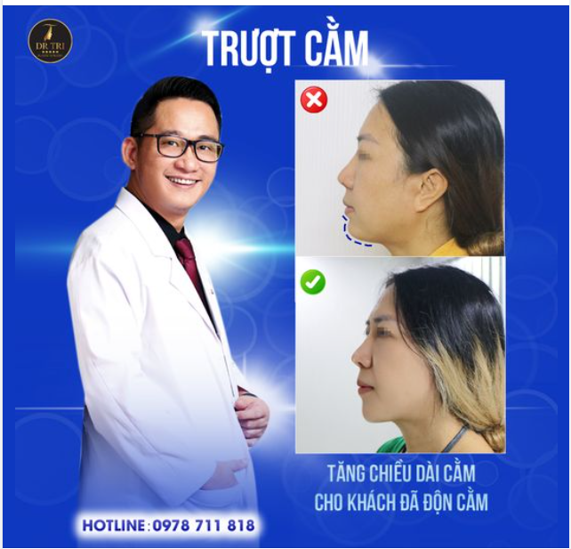 GÓC NGHIÊNG ĐẸP...HẾT HỒN...NHỜ TRƯỢT CẰM