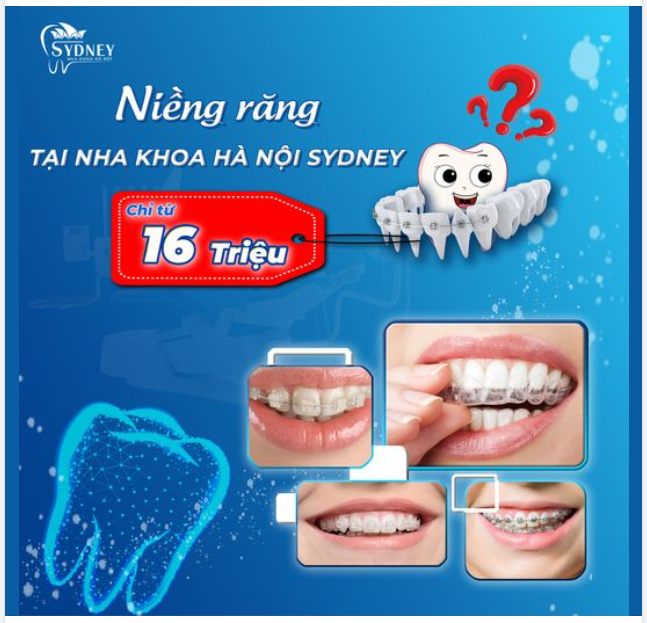 NIỀNG RĂNG TẠI NHA KHOA HÀ NỘI SYDNEY GIÁ BAO NHIÊU?