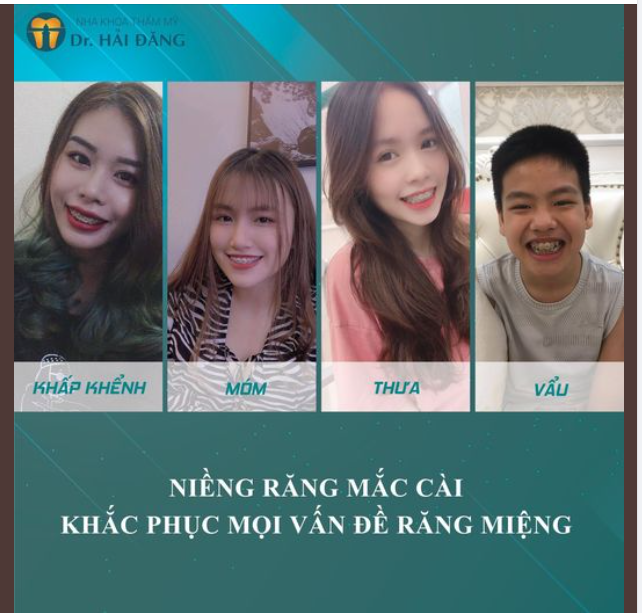 Bạn đang mong muốn sở hữu nụ cười rạng rỡ với hàm răng đều đặn?