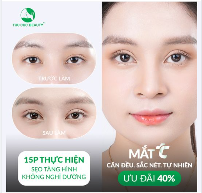 15P xóa sổ tình trạng mí lệch, nhiều nếp mí Chọn Mắt TC 15 phút thực hiện