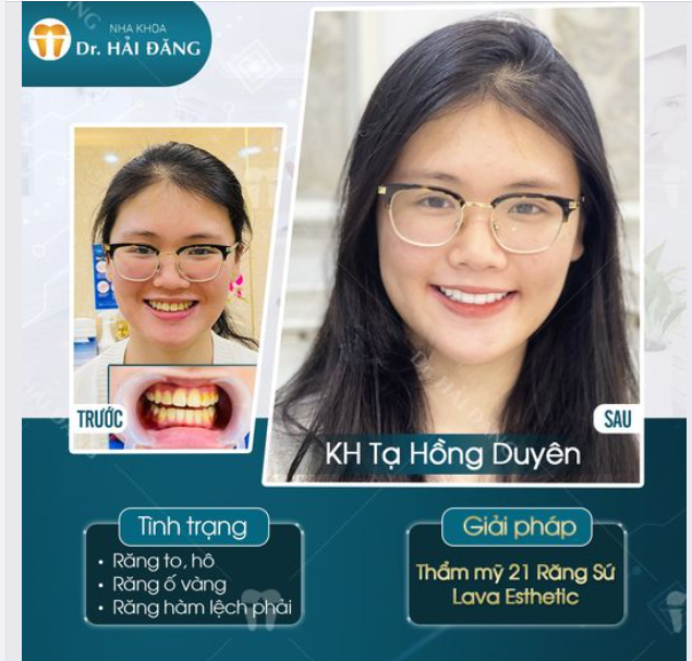 Bí quyết lột xác ngoạn mục với nụ cười rạng rỡ thay đổi cuộc đời  - Câu chuyện của chị Duyên